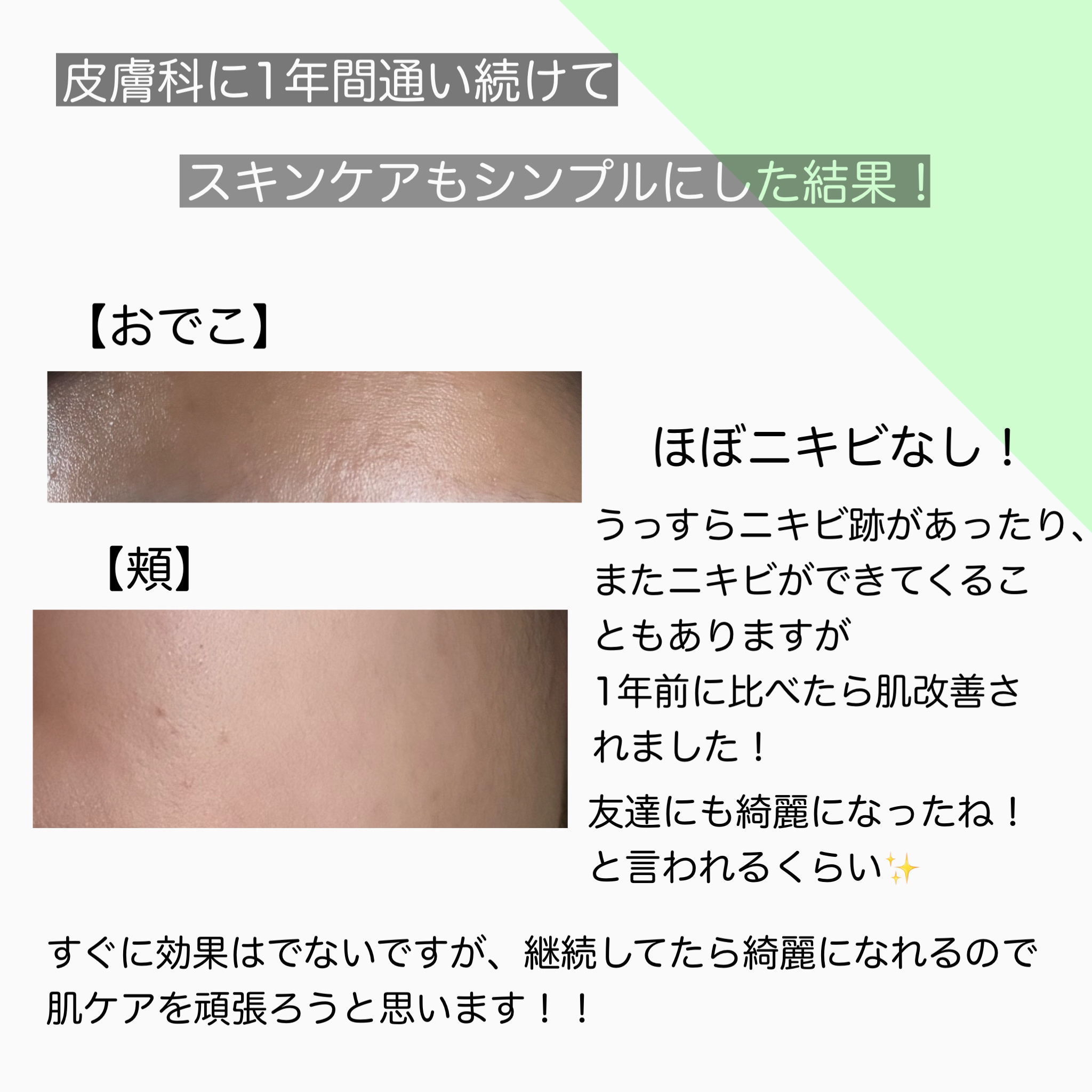 ザ・タイムR アクア/IPSA/化粧水を使ったクチコミ（3枚目）