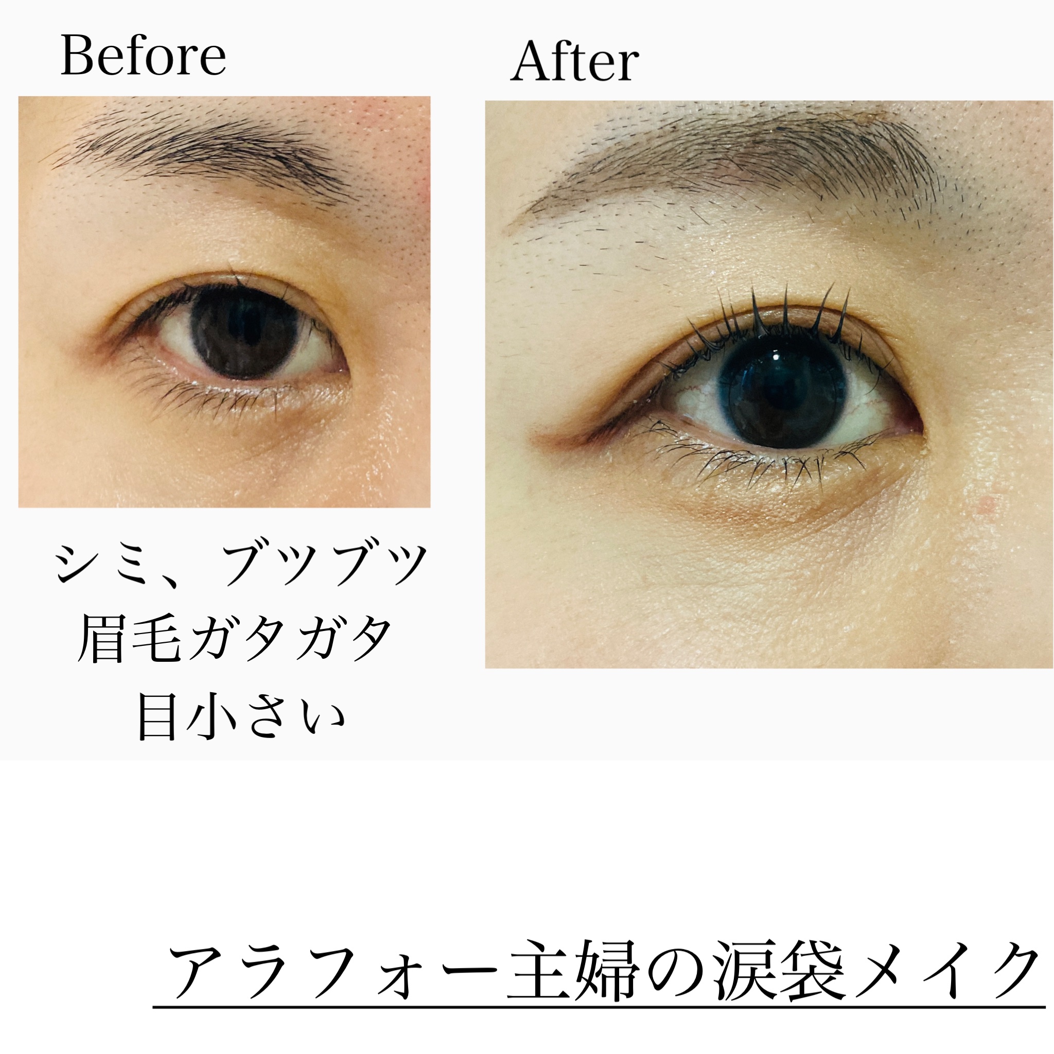 金のプラセンタもっちり白肌濃シワトール/ホワイトラベル/アイケア・アイクリームを使ったクチコミ（2枚目）