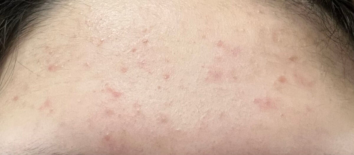 ハトムギ保湿ジェル(ナチュリエ スキンコンディショニングジェル)/ナチュリエ/美容液を使ったクチコミ(3枚目)