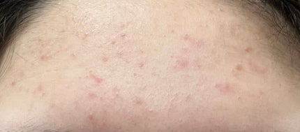 ハトムギ保湿ジェル(ナチュリエ スキンコンディショニングジェル)/ナチュリエ/美容液を使ったクチコミ(3枚目)