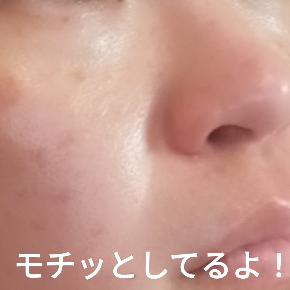 バイオームビタCダークスポットセラム/UIQ/美容液を使ったクチコミ（3枚目）