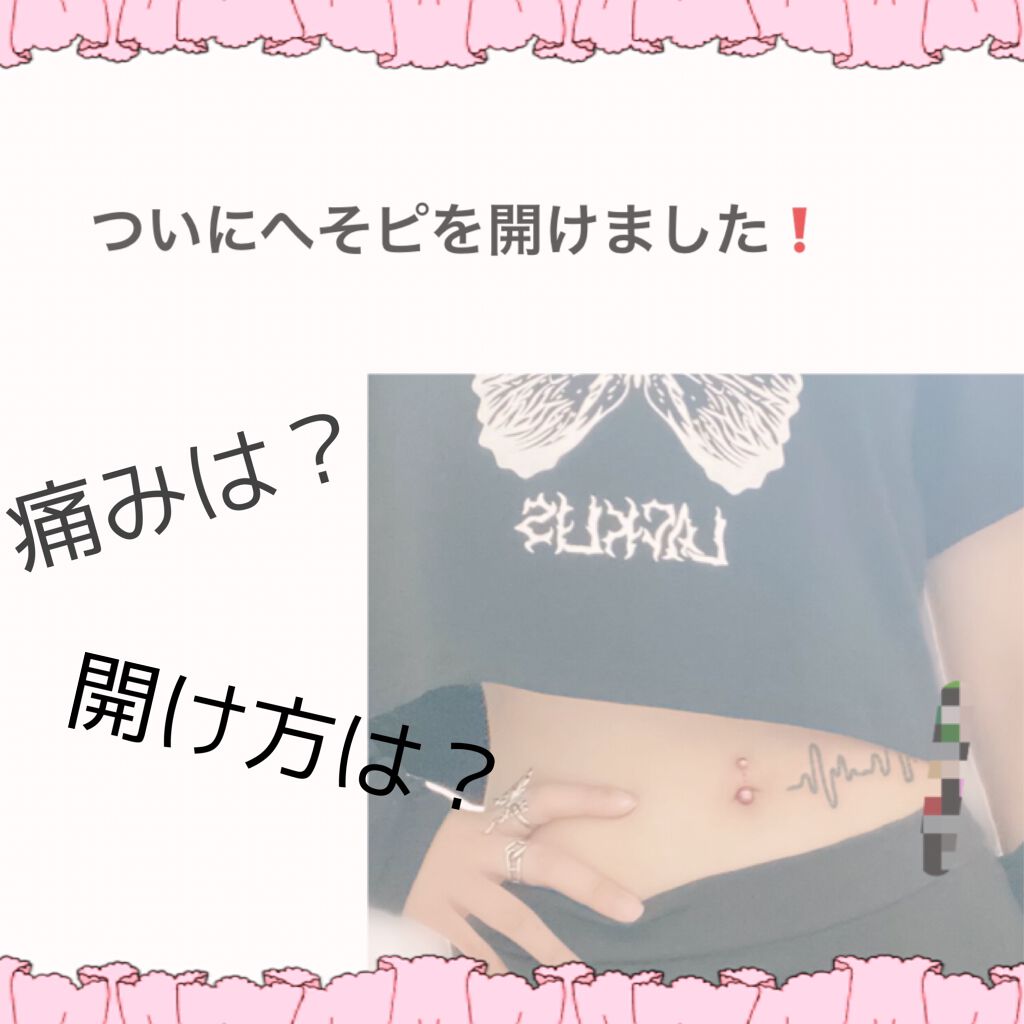 オロナインH軟膏 (医薬品)/オロナイン/その他を使ったクチコミ(1枚目)