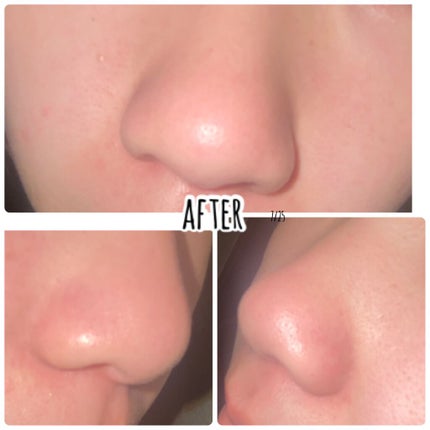 ロゼット洗顔パスタ ブラックパール/ロゼット/洗顔フォームを使ったクチコミ(2枚目)