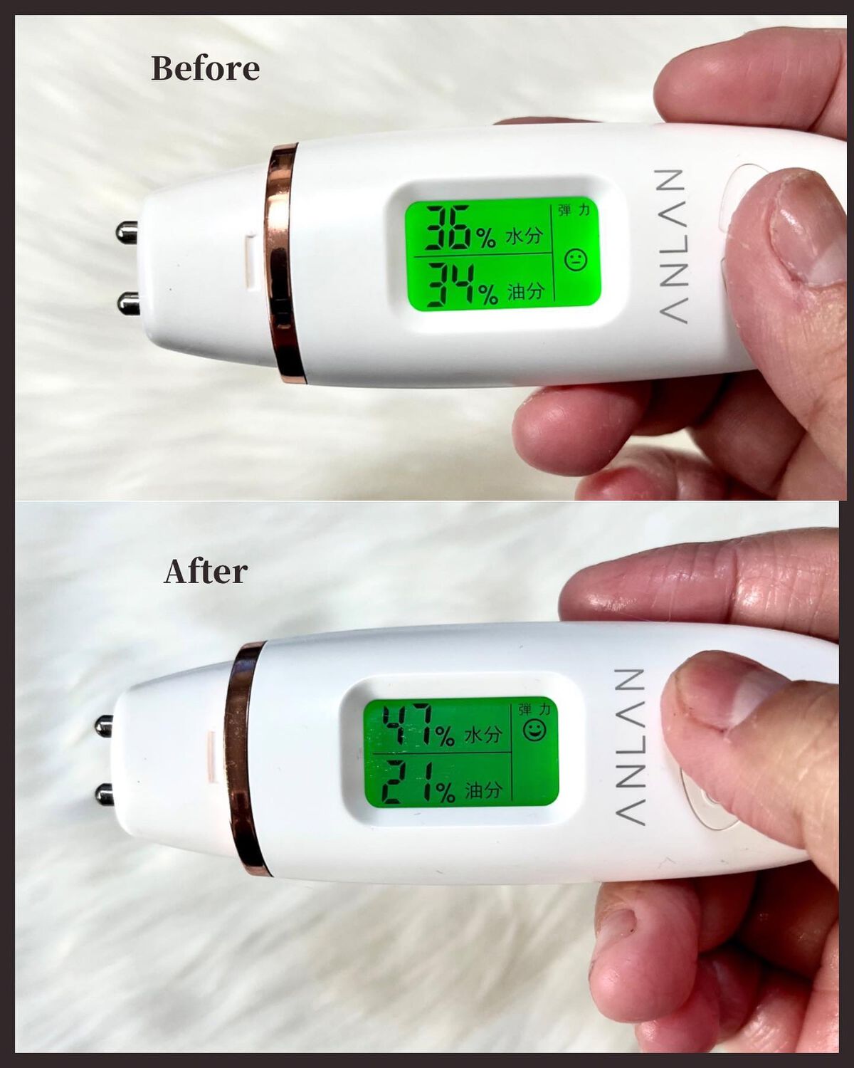 フィト シカノール B5 カーミングドロップゲルクリーム/MEDIPEEL/フェイスクリームを使ったクチコミ(5枚目)