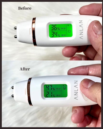 フィト シカノール B5 カーミングドロップゲルクリーム/MEDIPEEL/フェイスクリームを使ったクチコミ(5枚目)