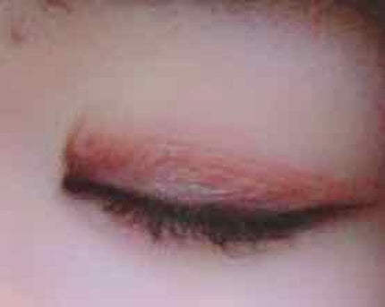 ハイブリッドフィルム/アイトーク/二重まぶた用アイテムを使ったクチコミ(3枚目)