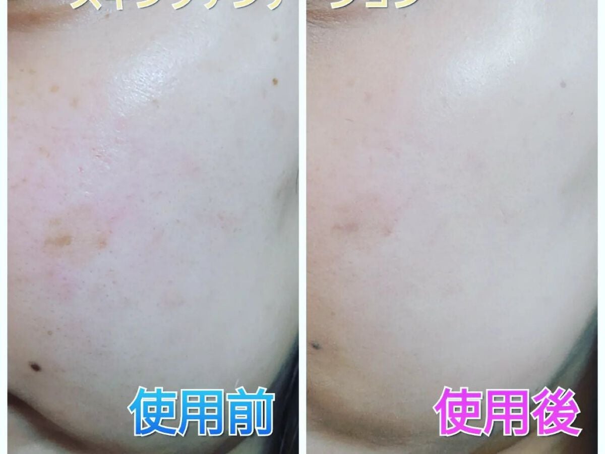 ブライトアップスキンファンデーション/UUUNI/クッションファンデーションを使ったクチコミ(5枚目)