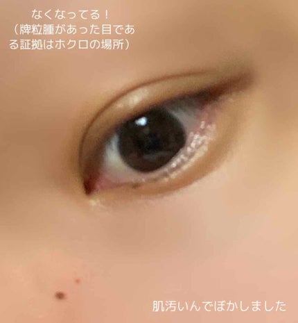 美味しいマウンテン on LIPS 「【完全に自己責任で行ってください】【健康に害はないので取る必要..」(2枚目)