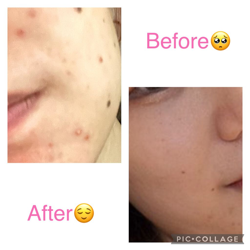 ドクタージャルト シカペア リカバー (第2世代)/Dr.Jart+/フェイスクリームを使ったクチコミ(4枚目)