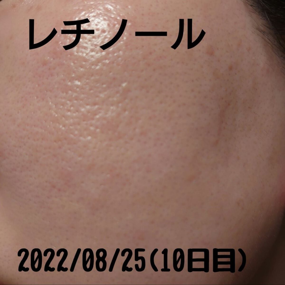 レチノールA 1% アドバンスドリバイタリゼーションクリーム/Life-flo/フェイスクリームを使ったクチコミ(4枚目)