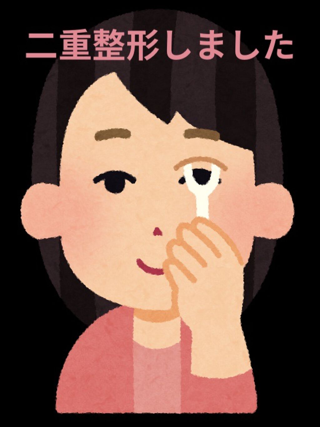 二重整形/その他を使ったクチコミ（1枚目）