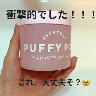 マイルドピーリングパッド N/PUFFY POD/ピーリングを使ったクチコミ（1枚目）