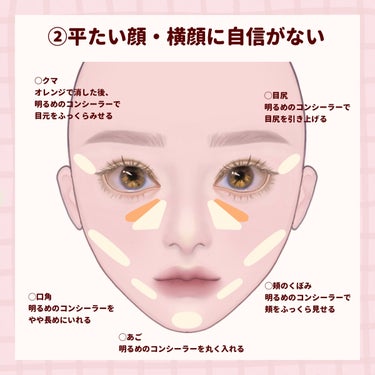 スポッツカバー ファウンデイション （ベースカラー）S300/SHISEIDO/クリームコンシーラーを使ったクチコミ（3枚目）