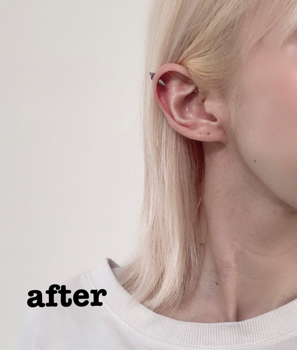 ベースアップブリーチ/ビューティーン/ブリーチ剤を使ったクチコミ(3枚目)