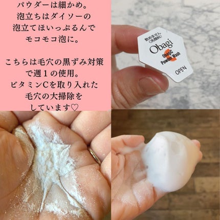 Aya |LAåšäœðºðž on LIPS ãæ¯ç©Žããã£ãã倧æé€ãã¹ããã¯å¿
é ã®é
µçŽ æŽé¡ã®ã玹ä»ã§ããã¹ã€..ãïŒ1æç®ïŒ