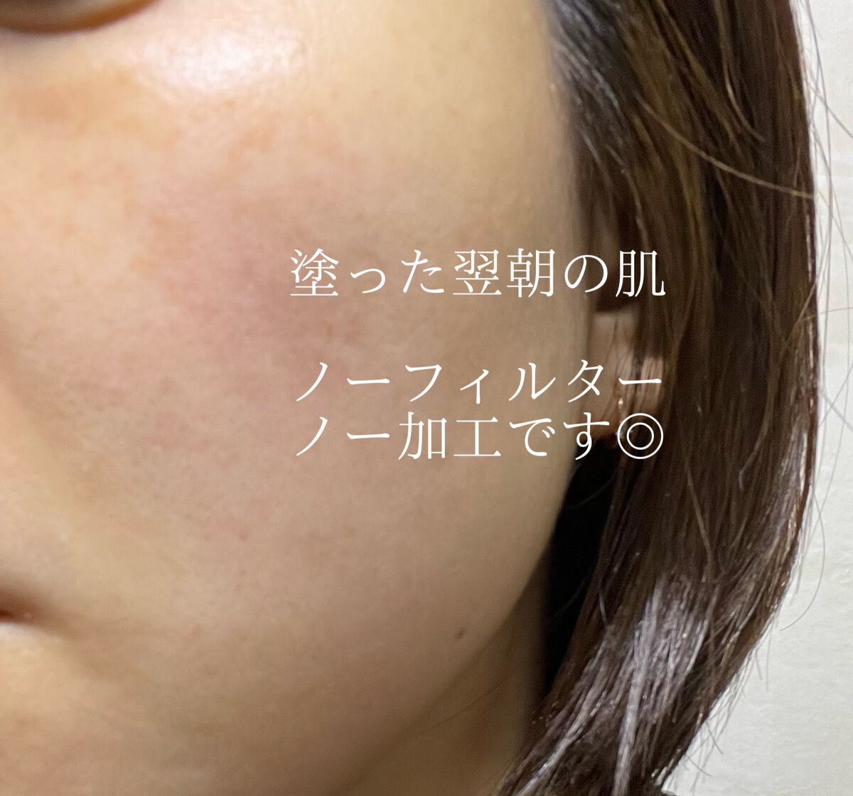 ユース ラディアンス ビタチノール セラム/primera/美容液を使ったクチコミ(4枚目)