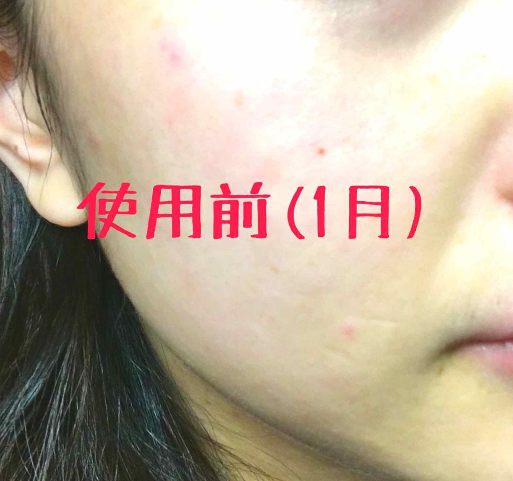 カプチュール ユース レッドネス ミニマイザー/Dior/美容液を使ったクチコミ(2枚目)