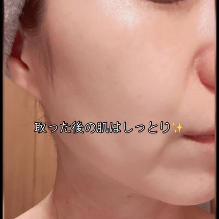 デイリーナイトマスク/You be YOU/シートマスク・パックを使ったクチコミ(8枚目)