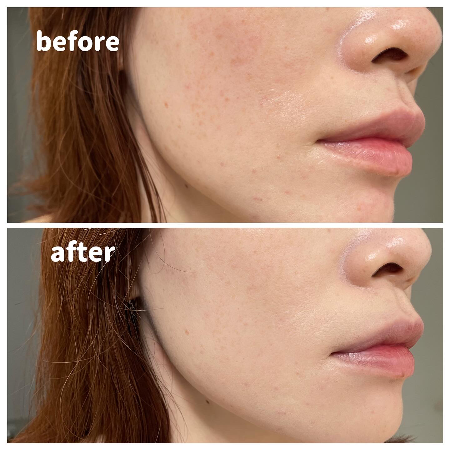 エフェクト ライク フィニッシュ クッション ファンデーション/vim BEAUTY/クッションファンデーションを使ったクチコミ（3枚目）