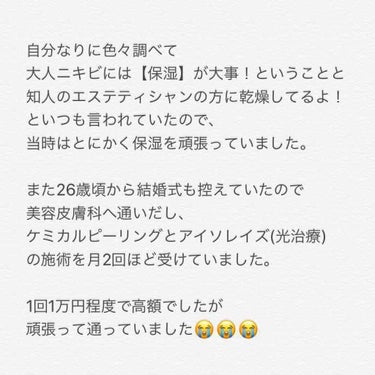 超絶敏感肌のズボラ女子 on LIPS 「今日は脂漏性皮膚炎と診断される前のスキンケアについて書きました..」（2枚目）