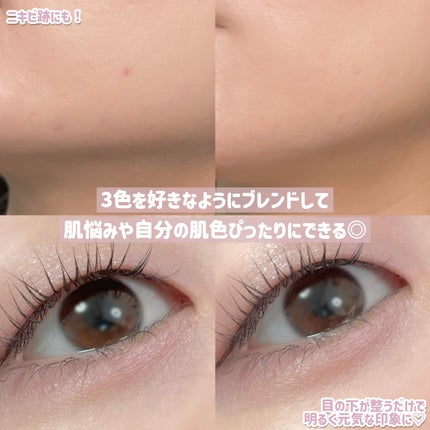 デイジードール コンシーラー パレット/DAISY DOLL by MARY QUANT/パレットコンシーラーを使ったクチコミ(6枚目)