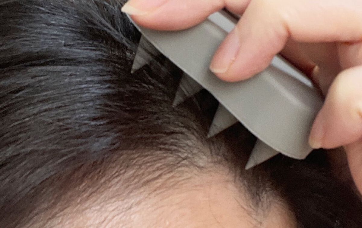 メディケイテッドスカルプフォーム/GROW LAB/頭皮ローションを使ったクチコミ（3枚目）