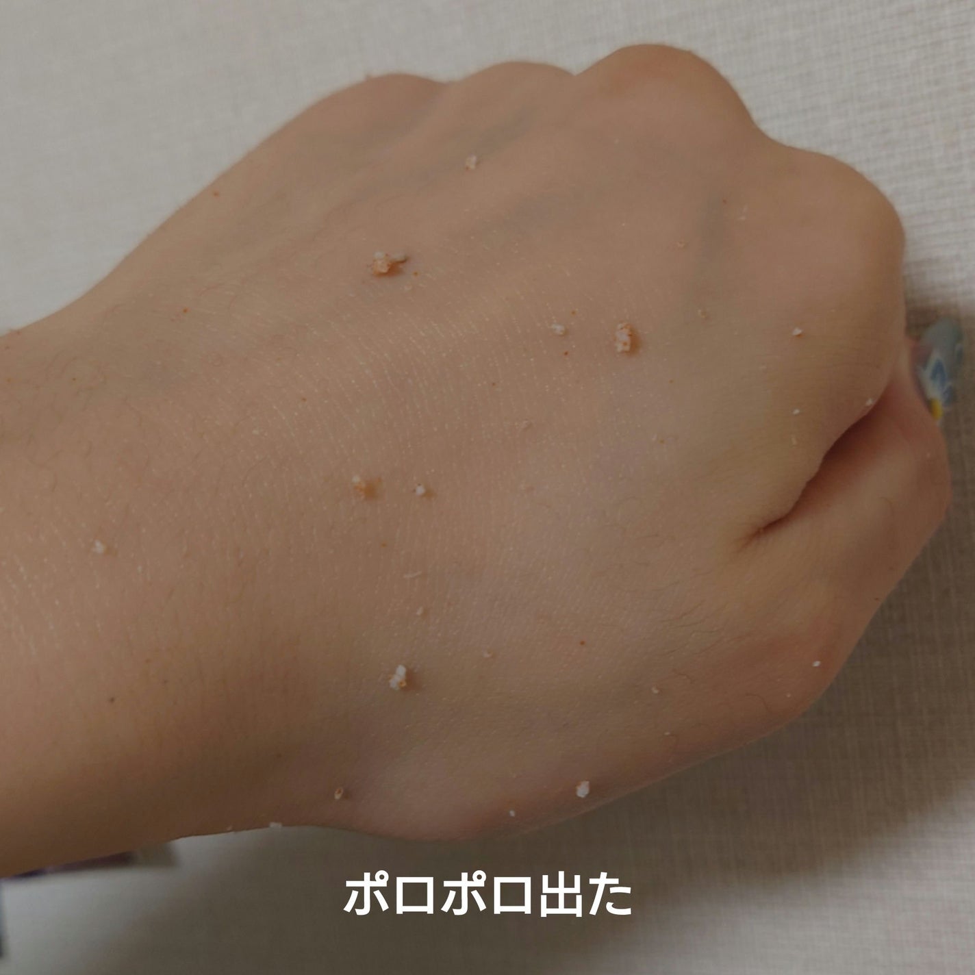 ヒップピーリングスクラブ/カントリー&ストリーム/ボディスクラブを使ったクチコミ(3枚目)