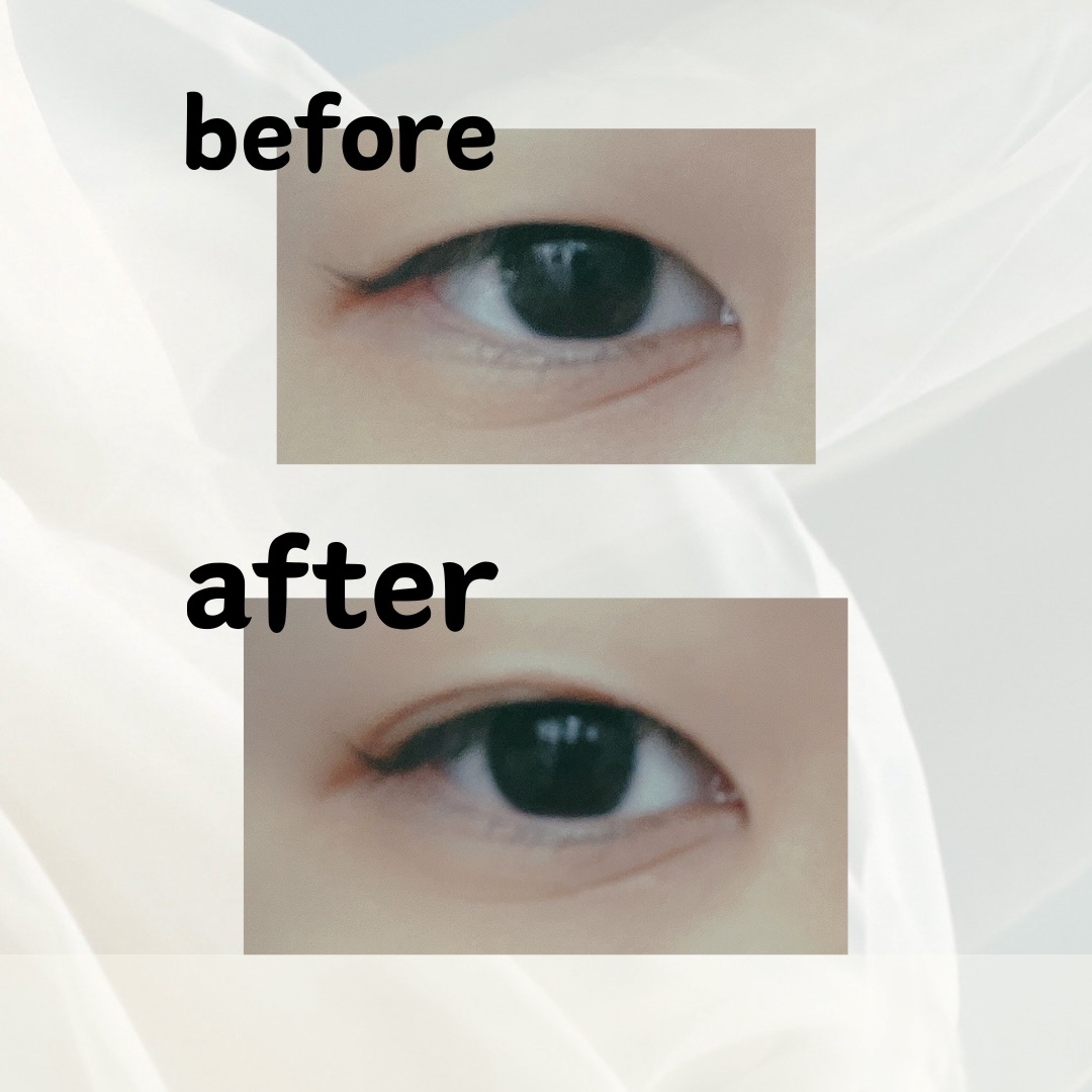 ダブリー/ルドゥーブル/二重まぶた用アイテムを使ったクチコミ（2枚目）