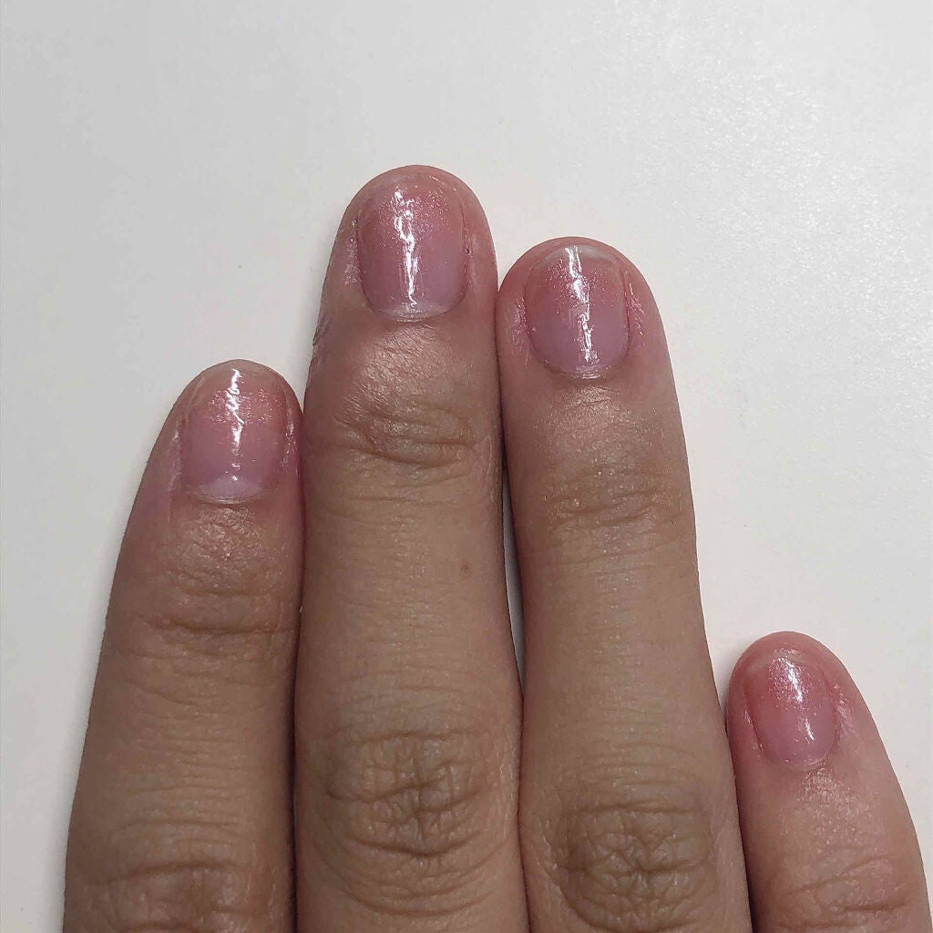 アトリックス ハンドジェル/アトリックス/ハンドジェルを使ったクチコミ(4枚目)