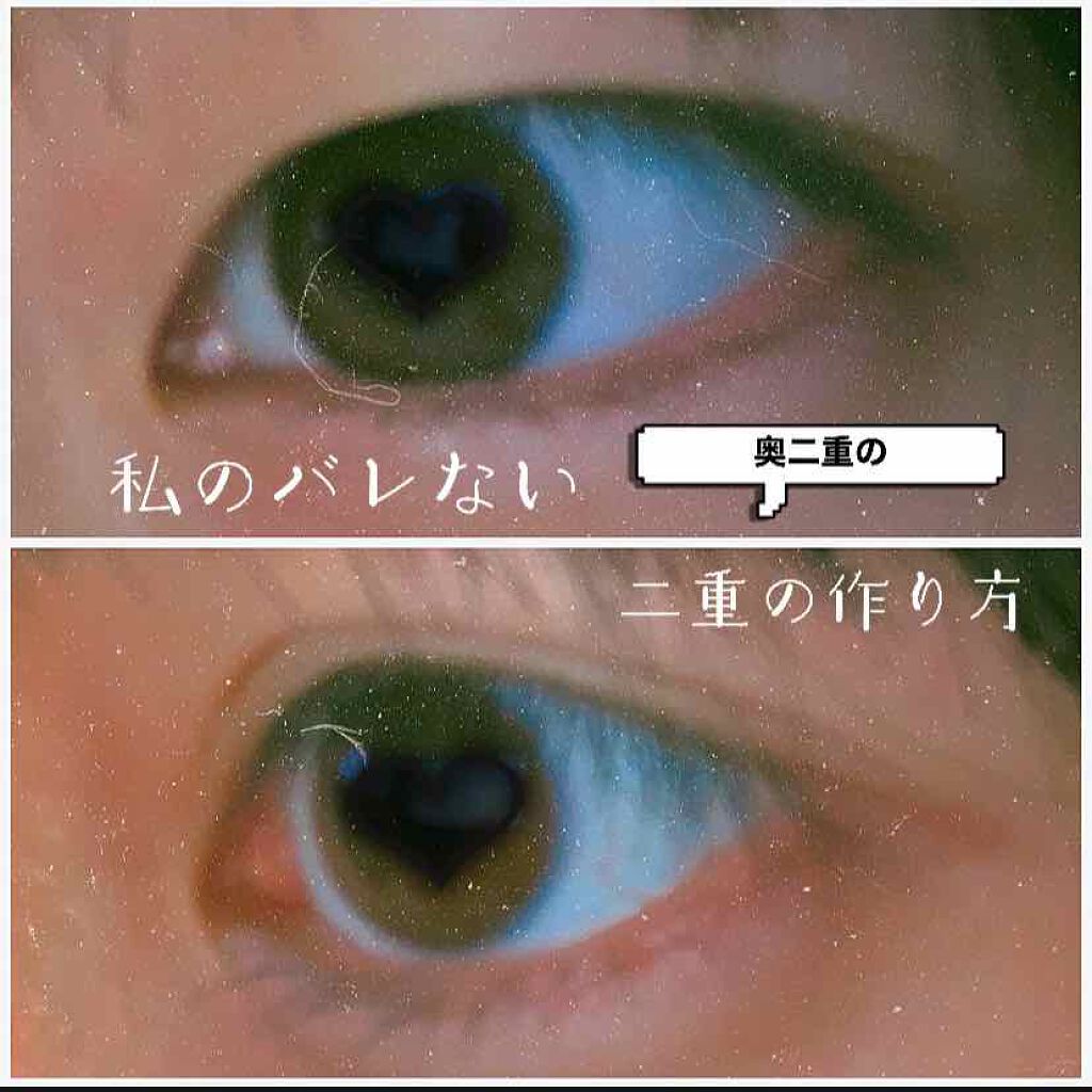 アイトーク/アイトーク/二重まぶた用アイテムを使ったクチコミ（1枚目）