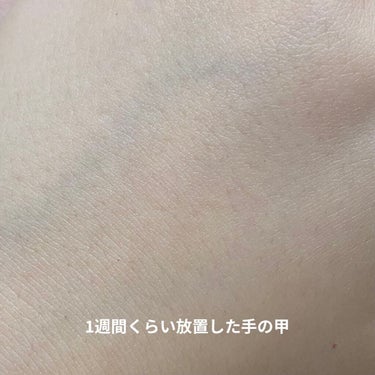 FASIZ HAIR REMOVAL 家庭用脱毛器/FASIZ/家庭用脱毛器を使ったクチコミ（3枚目）