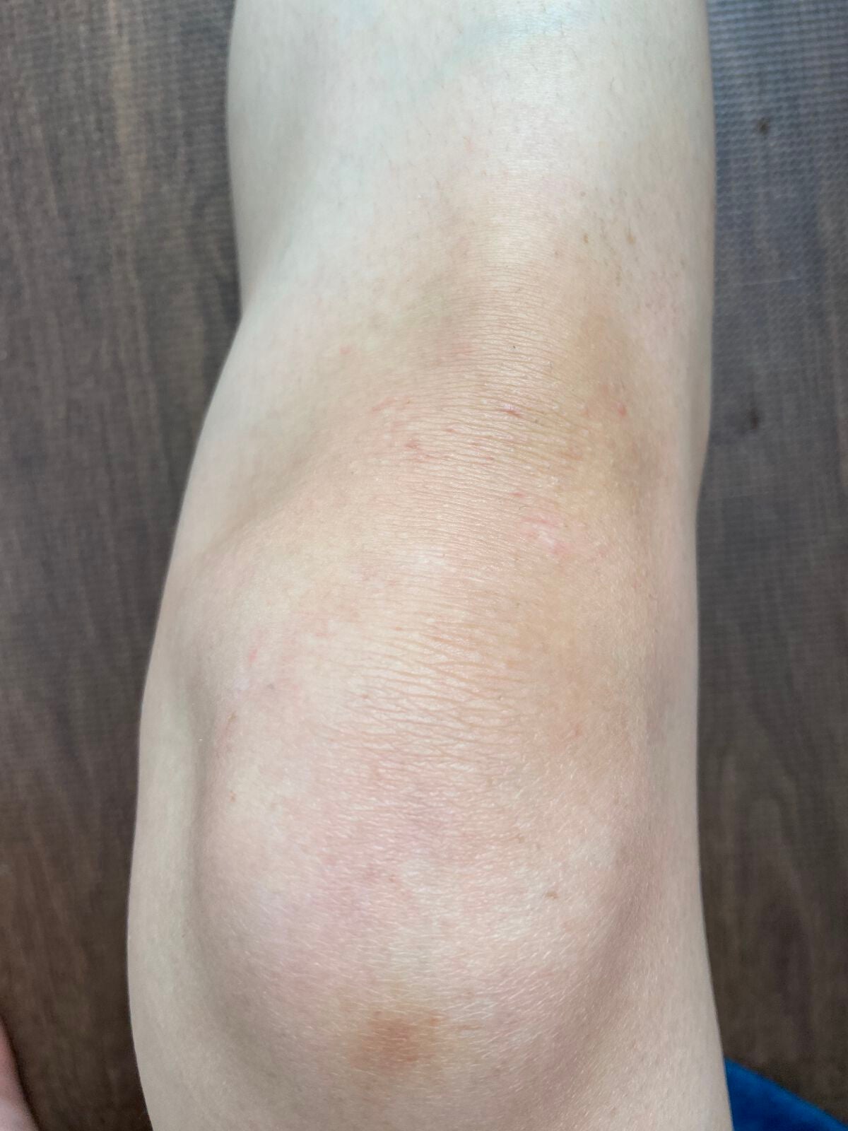 スキンスムーススクラブジェル/Beaumit/スクラブ・ゴマージュを使ったクチコミ(5枚目)