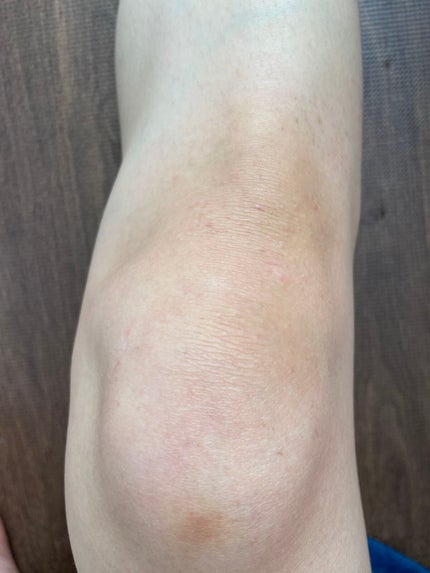 スキンスムーススクラブジェル/Beaumit/スクラブ・ゴマージュを使ったクチコミ(5枚目)