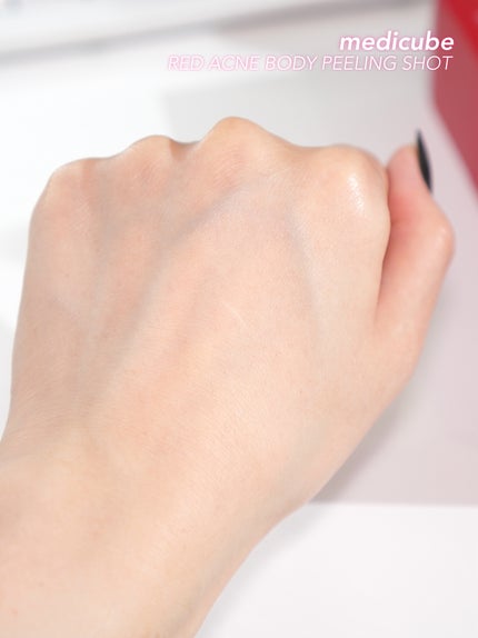 レッドアクネ ボディピーリングショット/MEDICUBE/ピーリングを使ったクチコミ(4枚目)