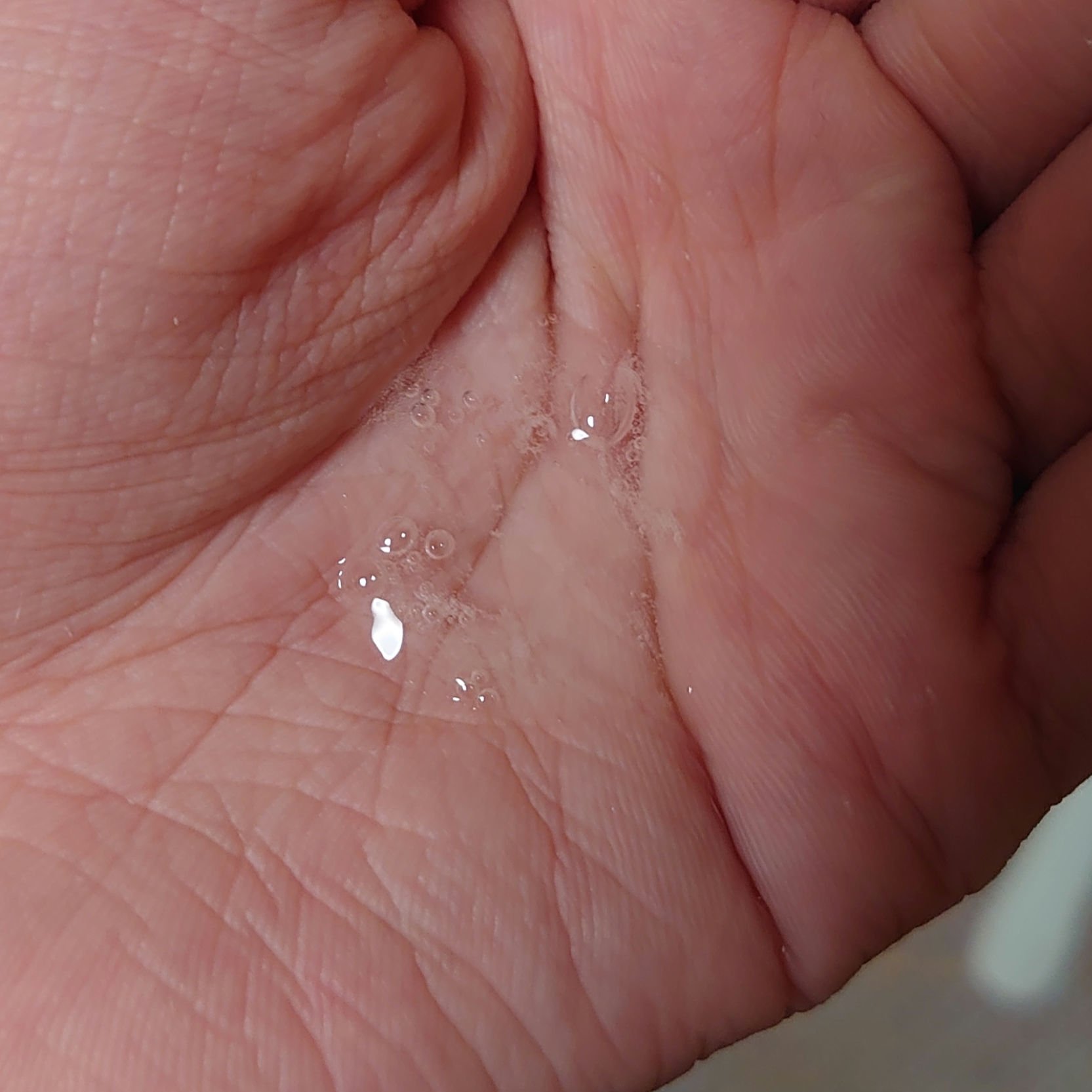 ヴィーガンスキンレリーフスージングエッセナー/MIGUHARA/化粧水を使ったクチコミ（2枚目）