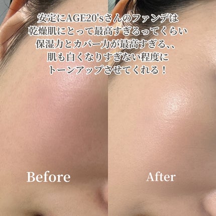 SIGNATURE ESSENCE COVER PACT /AGE20’s/クリーム・エマルジョンファンデーションを使ったクチコミ(4枚目)