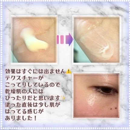 レチノールインテンシブ アドバンスドトリプルアクションアイクリーム/SOME BY MI/アイケア・アイクリームを使ったクチコミ(3枚目)