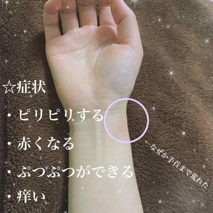 オロナインH軟膏 (医薬品)/オロナイン/その他を使ったクチコミ(3枚目)