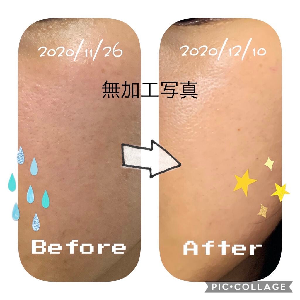 オードムーゲ 薬用ローション(ふきとり化粧水)/オードムーゲ/拭き取り化粧水を使ったクチコミ(2枚目)