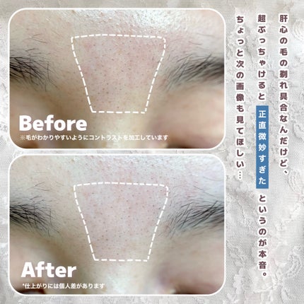 スキムシェーバー/ReFa/シェーバーを使ったクチコミ(6枚目)