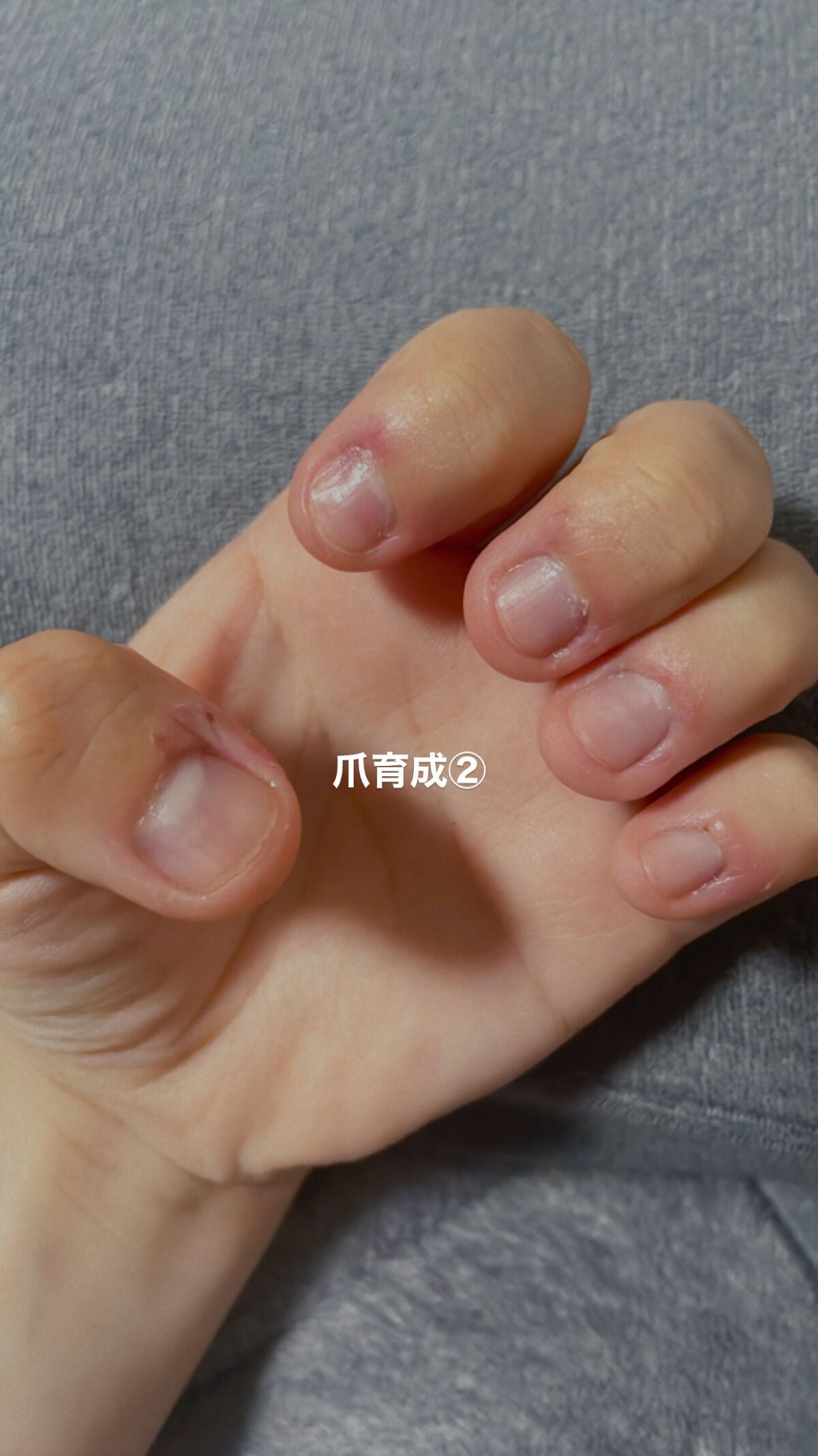 甘皮ケアオイル/無印良品/ネイルオイル・トリートメントを使ったクチコミ(1枚目)