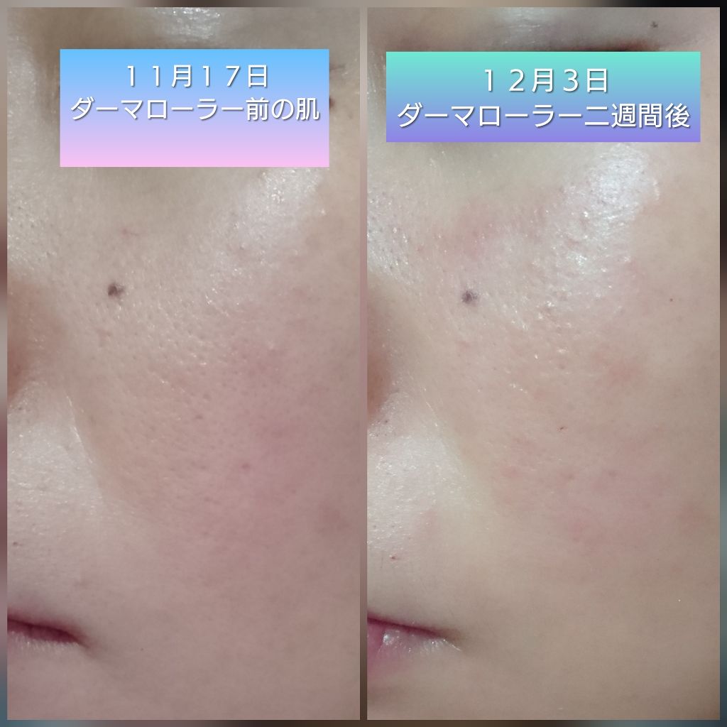 ドクタージャルト シカペア クリーム (第2世代)/Dr.Jart+/フェイスクリームを使ったクチコミ(3枚目)