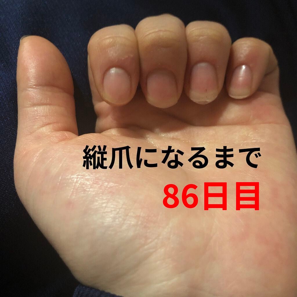 ð on LIPS ã瞊çªã«ãªãããã«ãããããªæ¹æ³ããã£ããæããŠãã ããð瞊çªã«..ãïŒ1æç®ïŒ