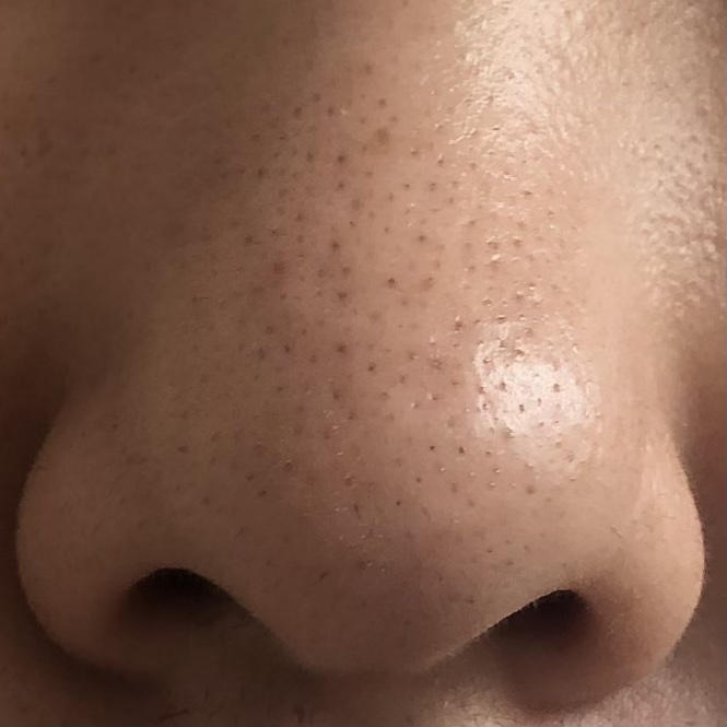 リードルショット クレンザー/VT/洗顔フォームを使ったクチコミ（3枚目）