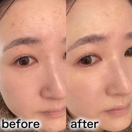 lovelycc マジックカバーチートコンシーラー/LOVELYCC/パレットコンシーラーを使ったクチコミ(4枚目)