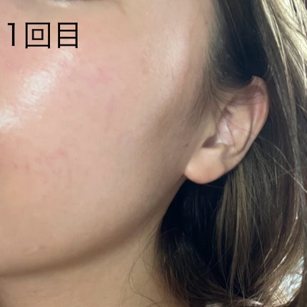 トリデン ダイブインマスクパック/Torriden/シートマスク・パックを使ったクチコミ(2枚目)