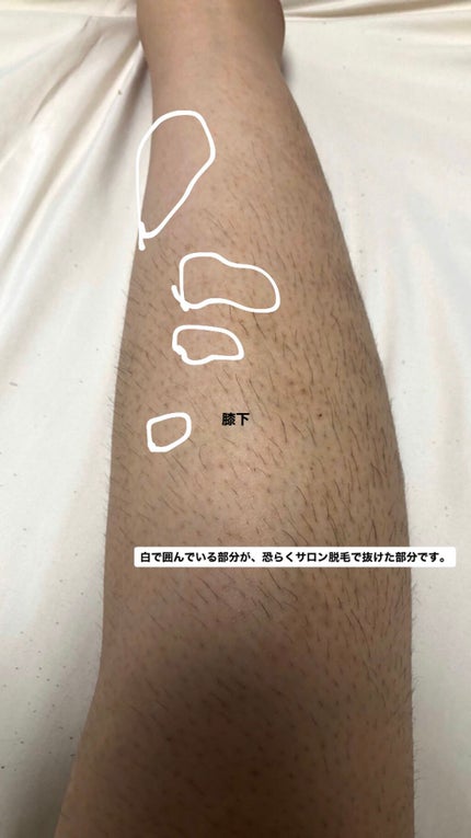 剛毛女 on LIPS 「⚠︎⚠︎⚠︎閲覧注意⚠︎⚠︎⚠︎すっごーーーーーく汚い写真です..」(5枚目)