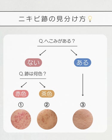 ブラン マジックティーツリーオイルのクチコミ「【これさえ読めばニキビ跡ゼロ🥹✨】ニキビ跡ケア完全保存版✍
⁡
今回紹介するのは、よくリク.....」（2枚目）