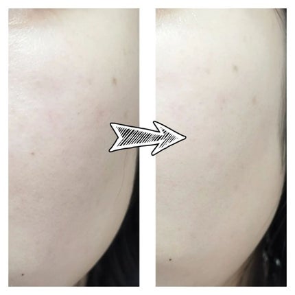 シークレットビューティーパウダー/キャンメイク/プレストパウダーを使ったクチコミ(2枚目)