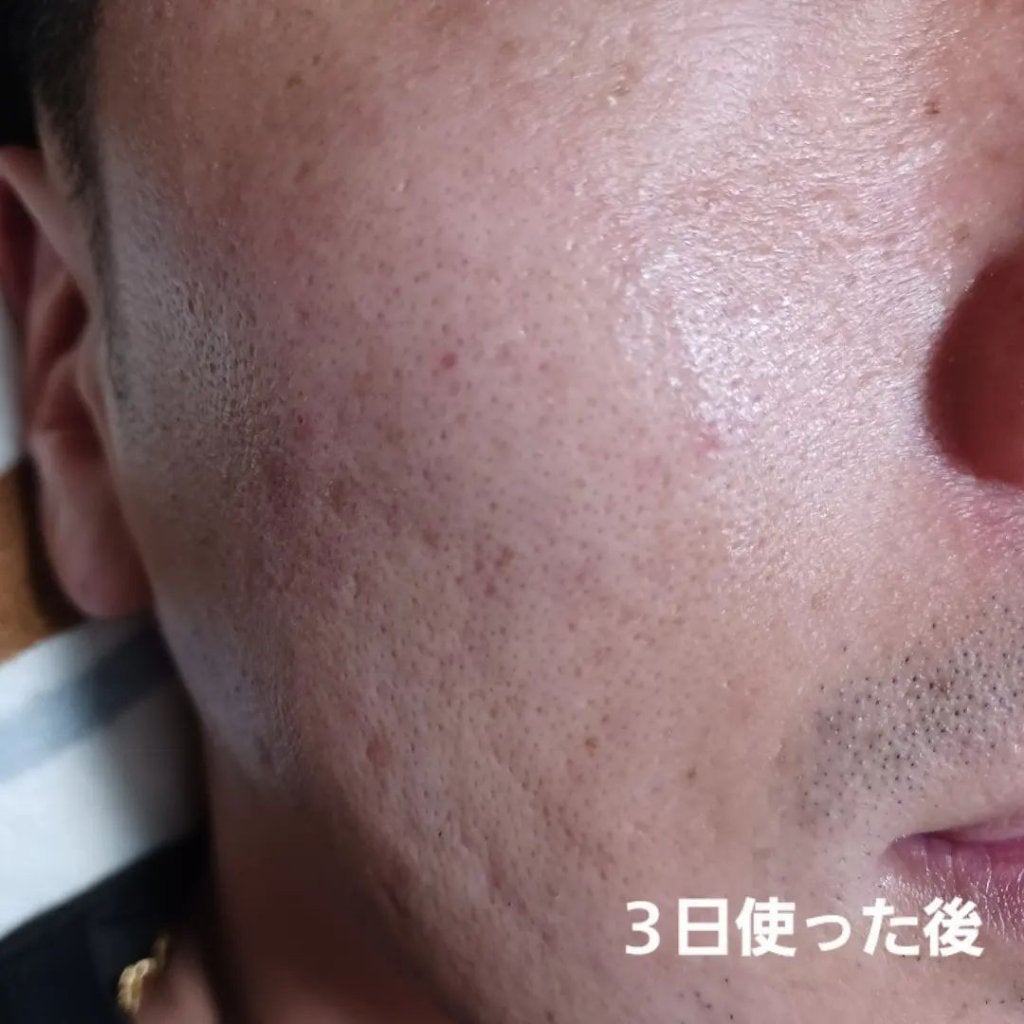 マジックティーツリーオイル/ブラン/フェイスオイルを使ったクチコミ(4枚目)